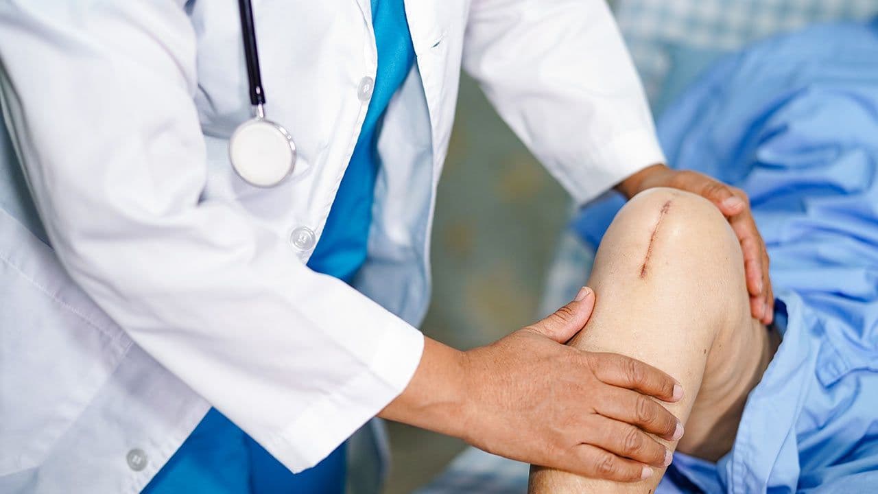 Orthopaedic surgeon reviewing knee replacement implant with patient